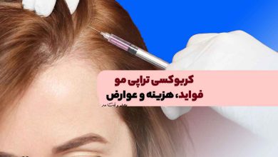 کربوکسی تراپی مو و درمان ریزش مو! فواید، هزینه و عوارض کربوکسی تراپی مو را بشناسید!