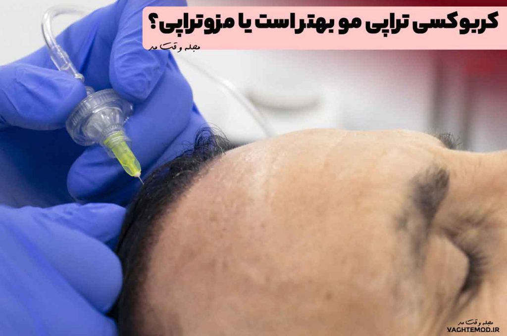 کربوکسی تراپی مو بهتر است یا مزوتراپی؟