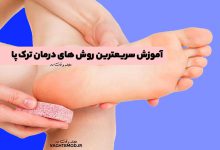 علت ترک پا چیست؟ آموزش پیشگیری از آن و سریعترین روش های درمان ترک پا