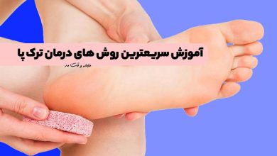 علت ترک پا چیست؟ آموزش پیشگیری از آن و سریعترین روش های درمان ترک پا