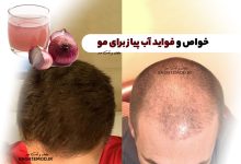 خواص و فواید آب پیاز برای مو! آموزش استفاده از آب پیاز برای تقویت مو!