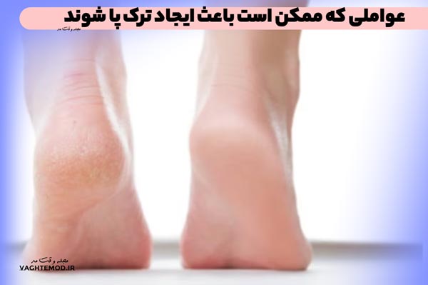 عواملی که ممکن است باعث ایجاد ترک پا شوند شامل این موارد است